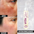 Sérum Aclarante y Antimanchas con Retinol - Vitaglow